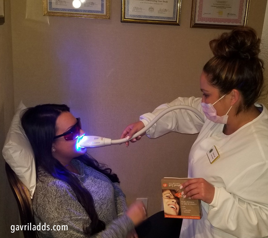 teeth whitening